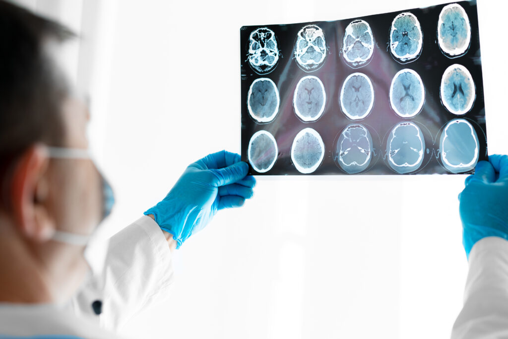 Consultório neurológico em Itaquera: Saúde cerebral ao seu alcance na Doutor SP
