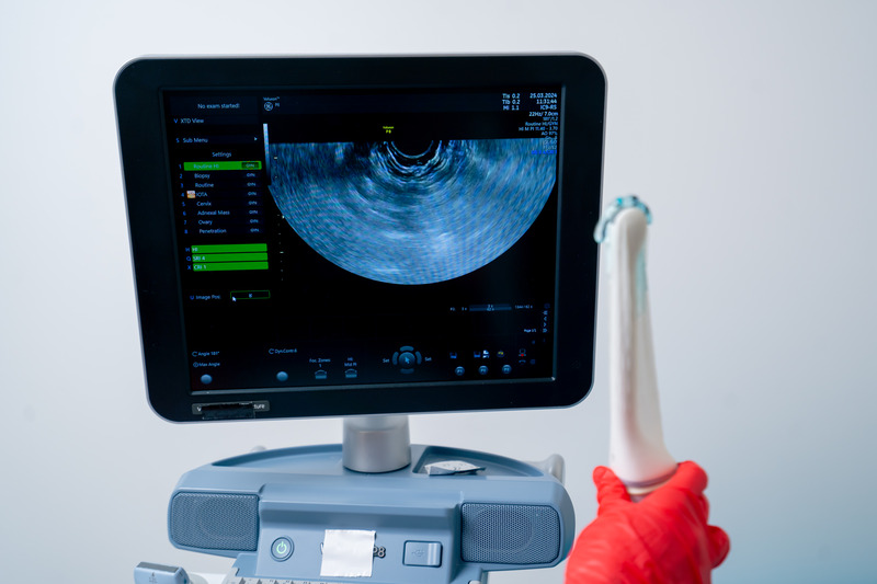 Ultrassom transvaginal em Itaquera: exame com conforto e agilidade na clínica Doutor SP
