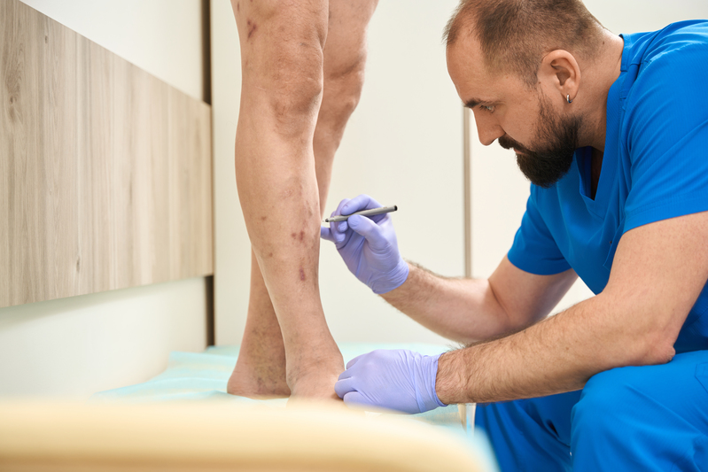 Consulta com vascular para varizes em São Miguel Paulista